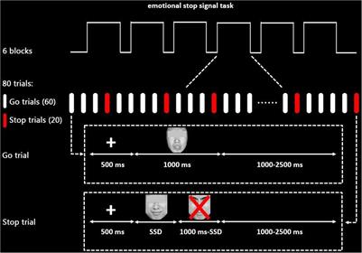 Negative Impact of Sadness on Response Inhibition in Females: An Explicit Emotional Stop Signal Task fMRI Study